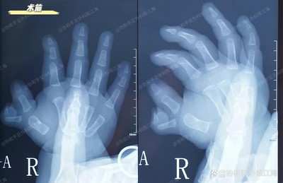 info-1242-803 info-1242-803